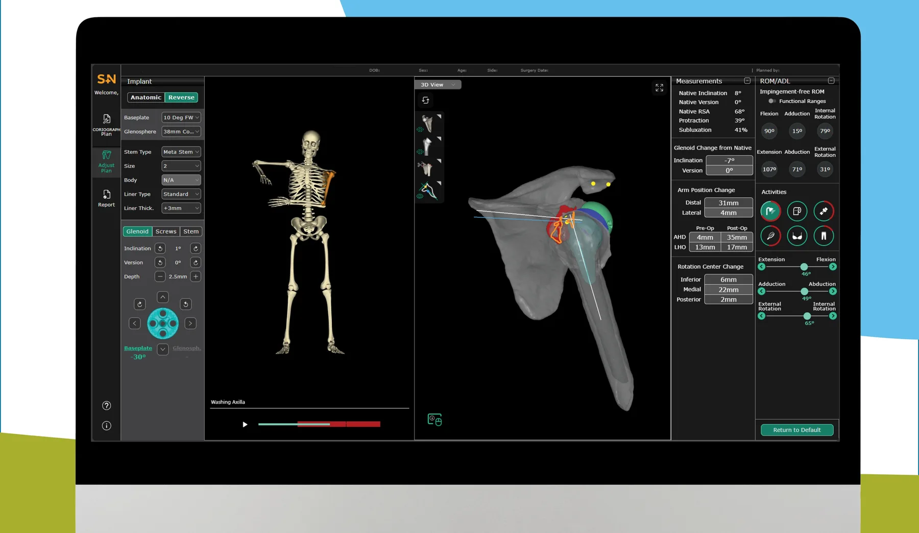 Smith+Nephew — Surgical Planner